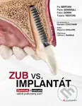 Zub vs. implantát - Pio Bertani, Paolo Generali, Fabio Gorni, Tiziano Testori - kniha z kategorie Medicína