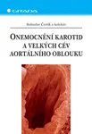 E-kniha: Onemocnění karotid a velkých cév aortálního oblouku od Čertík Bohuslav