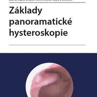 E-kniha: Základy panoramatické hysteroskopie od Kužel David