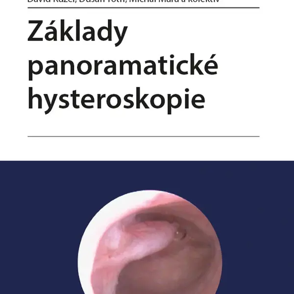 E-kniha: Základy panoramatické hysteroskopie od Kužel David