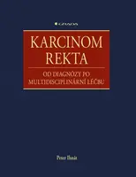 Karcinom rekta - Peter Ihnát - e-kniha