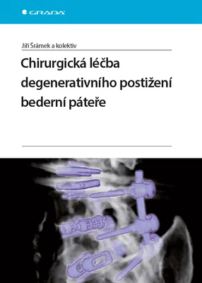 E-kniha: Chirurgická léčba degenerativního postižení bederní páteře od Šrámek Jiří