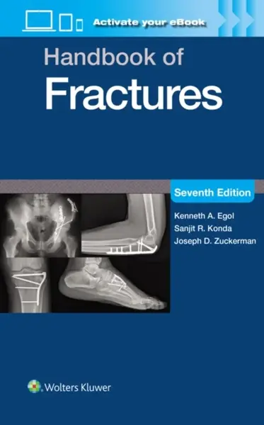 Handbook of Fractures: Print + eBook with Multimedia - Kenneth A. Egol, Senjit R. Konda, Joseph D. Zuckerman