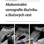 Abdominální sonografie žlučníku a žlučových cest - Iva Hoffmanová - kniha z kategorie Medicína