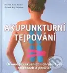 Akupunkturní tejpování (Účinné při akutních i chronických bolestech a potížích) - kniha z kategorie Masáže