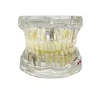 Model chrupu, zubných implantátov transparentný