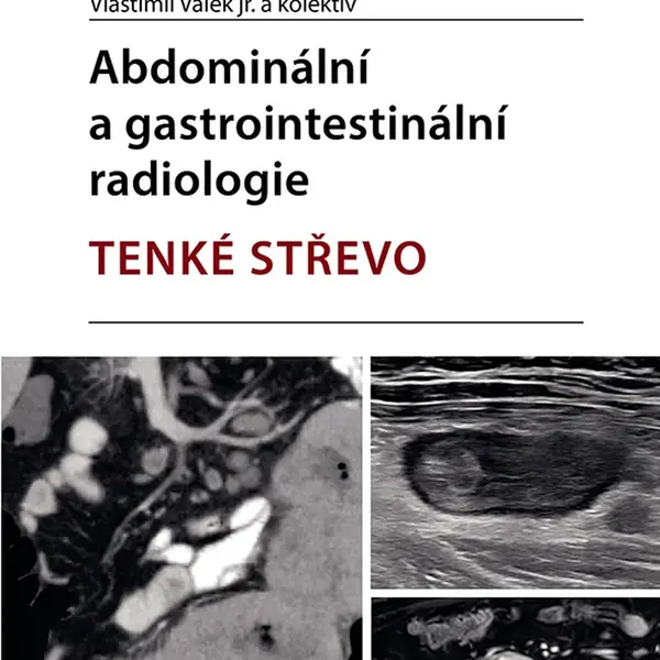 E-kniha: Abdominální a gastrointestinální radiologie od Válek jr. Vlastimil