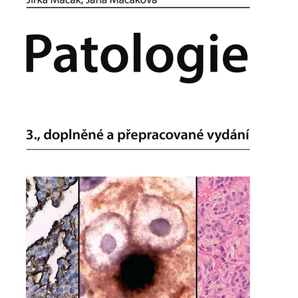 E-kniha: Patologie od Mačák Jirka