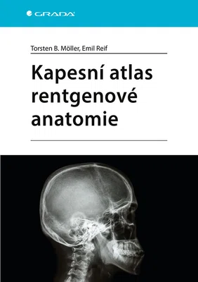 Kniha: Kapesní atlas rentgenové anatomie od Möller Torsten B.