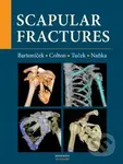 Scapular fractures - Jan Bartoníček, Michal Tuček, Ondřej Naňka - kniha z kategorie Medicína