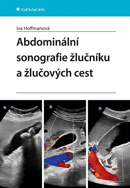Abdominální sonografie žlučníku a žlučových cest, Hoffmanová Iva