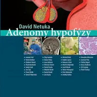 Adenomy hypofýzy - David Netuka