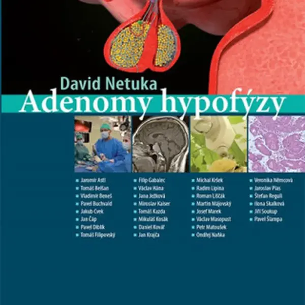 Adenomy hypofýzy - David Netuka