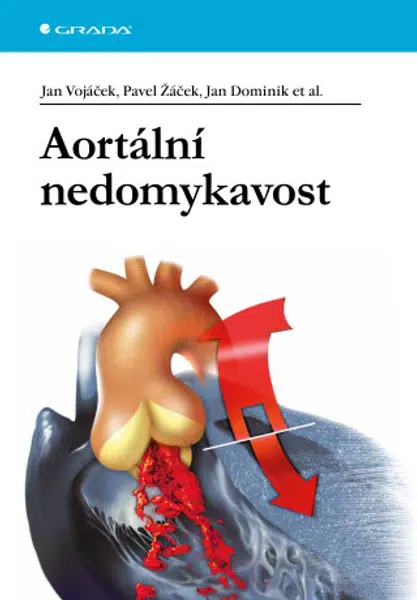 Aortální nedomykavost - Jan Vojáček, Pavel Žáček, Jan Dominik - e-kniha