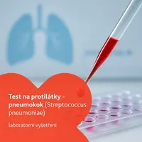 Test na protilátky - pneumokok laboratorní vyšetření