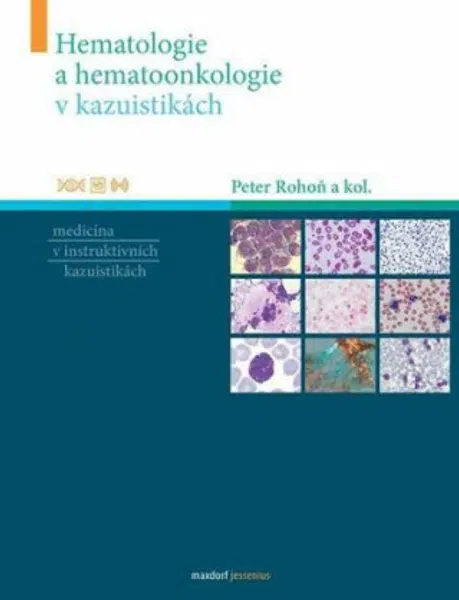 Hematologie a hemootonkologie v kazuistikách - Peter Rohoň