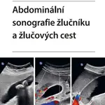 Abdominální sonografie žlučníku a žlučových cest - Iva Hoffmanová - e-kniha