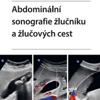 Abdominální sonografie žlučníku a žlučových cest - Iva Hoffmanová - e-kniha