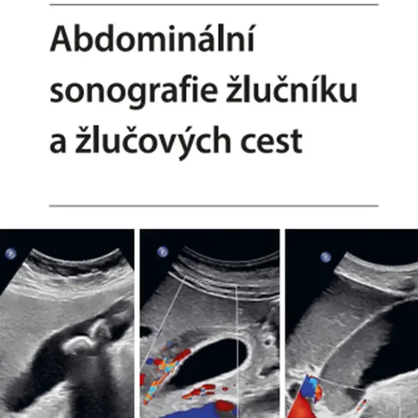 Abdominální sonografie žlučníku a žlučových cest - Iva Hoffmanová - e-kniha