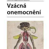 Vzácná onemocnění, Kopečková Kateřina