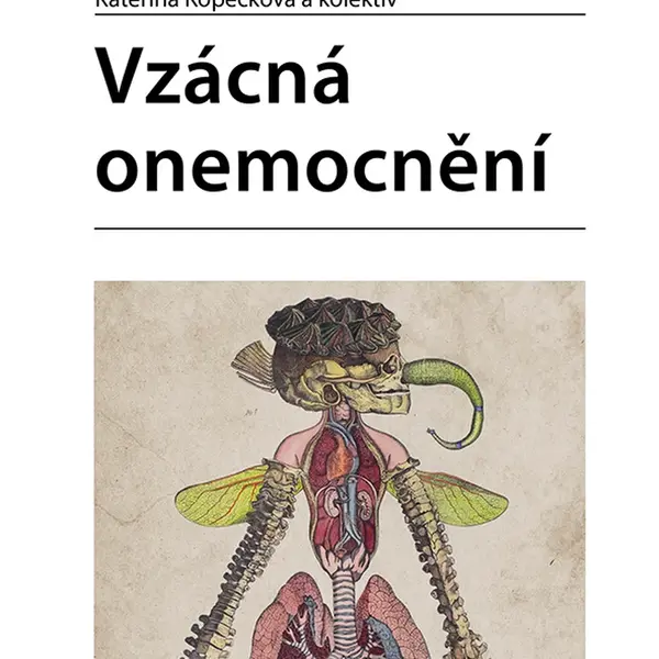 Vzácná onemocnění, Kopečková Kateřina