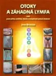 Otoky a záhadná lymfa (aneb pravé příčiny celulitidy, obezity a neúspěšných pokusů zhubnout) - kniha z kategorie Alternativní medicína