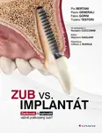 Zub vs. implantát - Bertani Pio, Generali Paolo, Gorni Fabio, Testori Tiziano