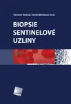 Biopsie sentinelové uzliny - Čestmír Neoral, Tomáš Bohanes