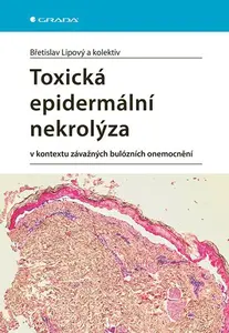 Toxická epidermální nekrolýza, Lipový Břetislav