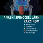 Anální spinocelulární karcinom
