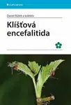 Klíšťová encefalitida - Daniel Růžek - e-kniha