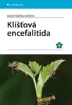 Klíšťová encefalitida - Daniel Růžek