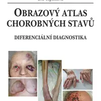 E-kniha: Obrazový atlas chorobných stavů od Topinková Eva